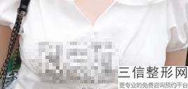 北京做胸口碑好的医院排行榜前四实力盘点,北京胸科医院排名前十