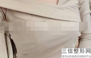 北京做胸口碑好的医院排行榜前四实力盘点,北京胸科医院排名前十
