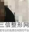 北京做胸口碑好的医院排行榜前四实力盘点,北京胸科医院排名前十