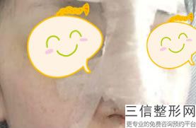 鼻王排名专家揭晓前四强,国内鼻综合十大专家