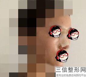 鼻王排名专家揭晓前四强,国内鼻综合十大专家