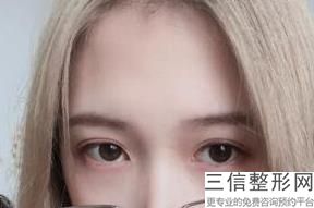 滨州整形医院排名榜前十权威盘点,滨州割双眼皮医院排名