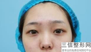 滨州整形医院排名榜前十权威盘点,滨州割双眼皮医院排名