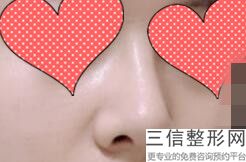 常州做鼻子整形医院前五vs前三,常州鼻部整形医院