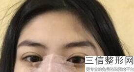 成都割双眼皮医院排名榜前六口碑盘点,成都名次靠前的割双眼皮医院