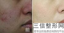 成都拉皮手术好的整形医院排名前五,成都拉皮手术良好的整形医院