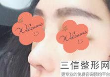 成都隆鼻医院排名前五权威公布,成都哪家医院隆鼻子良好的医院