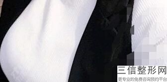 成都隆胸整形医院排名榜八强名次调整,成都整形医院排名前十名