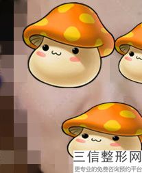 成都热玛吉在国内授权的机构排行榜前三被娇点,中国热玛吉总代理是哪家公司