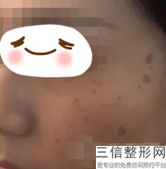 成都三甲医院做拉皮手术口碑排行榜前十,三甲医院做拉皮哪家好