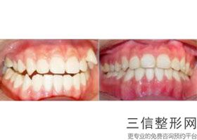 成都牙齿矫正口腔医院排行榜top6公布,成都矫牙医院推荐