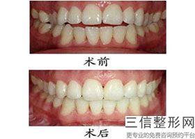 成都牙齿矫正口腔医院排名榜top5权威发布,成都三甲医院矫正牙齿好排行