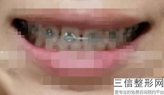 成都种植牙口腔医院排名榜top5权威发布,成都种植牙哪家医院好