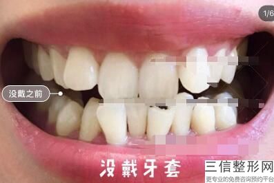 成都种植牙口腔医院排名榜top5权威发布,成都种植牙哪家医院好