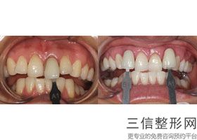 大连牙齿正畸医院排名榜top5民营汇总,大连哪个医院整牙好