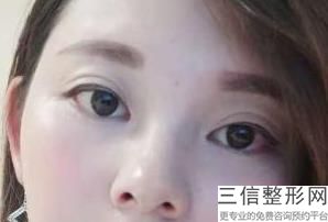 东莞市做眼修复整形医院前十名单表崭新曝光,东莞医美整形医院