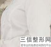 分享青岛假体隆胸整形医院排名前八实力榜,青岛 隆胸