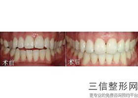 佛山市牙科医院排名榜top5,佛山市良好的牙科医院哪家良好