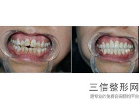 佛山市牙科医院排名榜top5,佛山市良好的牙科医院哪家良好