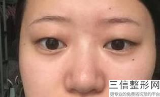 佛山眼部手术整形医院排行榜权威发布,佛山有哪些整形医院
