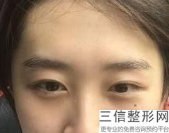 佛山眼部手术整形医院排行榜权威发布,佛山有哪些整形医院