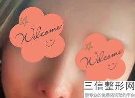 福州整形医院隆鼻排行榜前十pk,福州整形医院排名榜