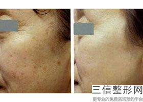 常州热玛吉认证授权医院查询,南京热玛吉官方认证的医院有哪些