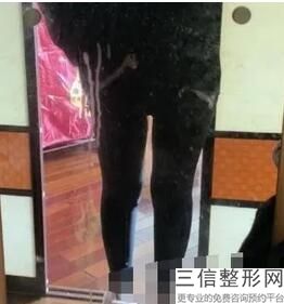 成都丰胸整形医院排名榜top5权威攻略,成都胸部整形哪家医院良好