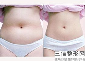 成都丰胸整形医院排名榜top5权威攻略,成都胸部整形哪家医院良好