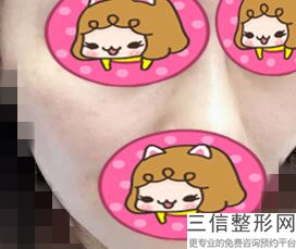 成都热玛吉认证医院排行榜top5实力盘点,成都热玛吉官网认证医院