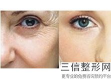 成都热玛吉五代整形医院排行榜前五,成都5a整形医院