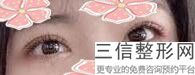 成都双眼皮全切整形医院排名前五,成都哪家医院割双眼皮好