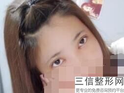成都眼科整形医院排名榜,成都前十的整形医院