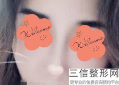 东莞胶原蛋白隆鼻美容整形医院排名,广东东莞整形美容医院排行榜