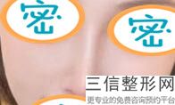东莞隆鼻整形医院排名榜三强盘点,东莞比较有名的整形医院是哪家