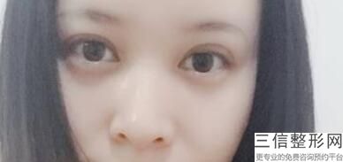佛山双眼皮整形医院排名前十名单表,佛山整形双眼皮医院哪家好