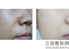 佛山做热玛吉的公立医院排行榜前五的,广州可以做热玛吉的医院