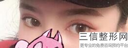 甘肃省双眼皮整形医院排名榜前五强实力盘点,甘肃双眼皮哪个医院好