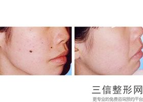 杭州哪家整形医院做拉皮除皱好,杭州权威整形美容医院