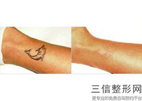 杭州热玛吉官方授权医院排名公布,杭州第一人民医院有热玛吉吗
