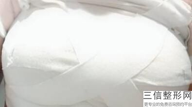 杭州胸部整容整形医院排名榜七强权威横评,杭州哪个医院做胸部整形好