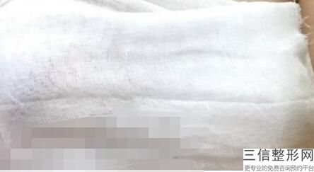 杭州胸部整容整形医院排名榜七强权威横评,杭州哪个医院做胸部整形好