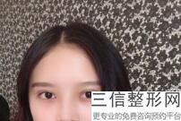 杭州有名的双眼皮整形医院排名前五强,杭州三甲医院双眼皮整形科哪家好