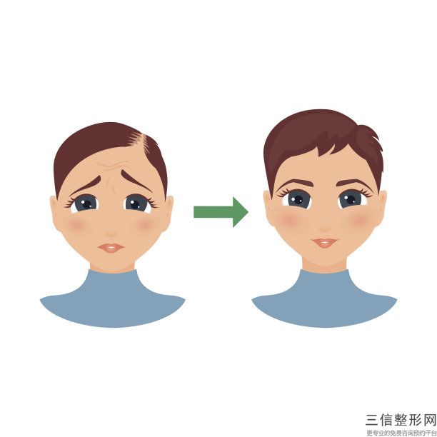 杭州植发效果比较好的植发整形机构都有哪些,杭州排名前十的植发医院