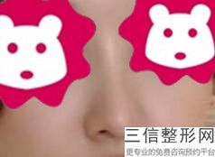 合肥隆鼻好的整形医院排行榜,合肥鼻子整形好的医院