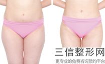 合肥隆胸医院排名榜前六强全新盘点,合肥丰胸医院哪家好