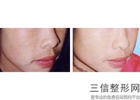 合肥热玛吉官网认证机构排行名单汇总,杭州热玛吉官网认证的机构