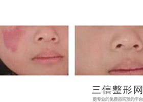 合肥热玛吉官网认证机构排行名单汇总,杭州热玛吉官网认证的机构