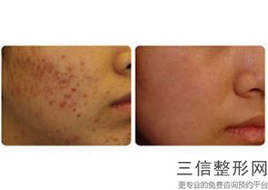 合肥热玛吉官网认证机构排行名单汇总,杭州热玛吉官网认证的机构