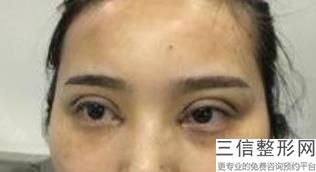 河北省好的眼部整形医院排行榜发布,河北省眼科比较好的医院